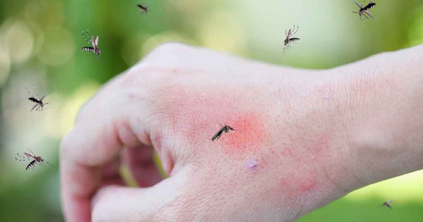 Imagem ilustrativa: Casos de Chikungunya preocupam prefeito de Água Santa