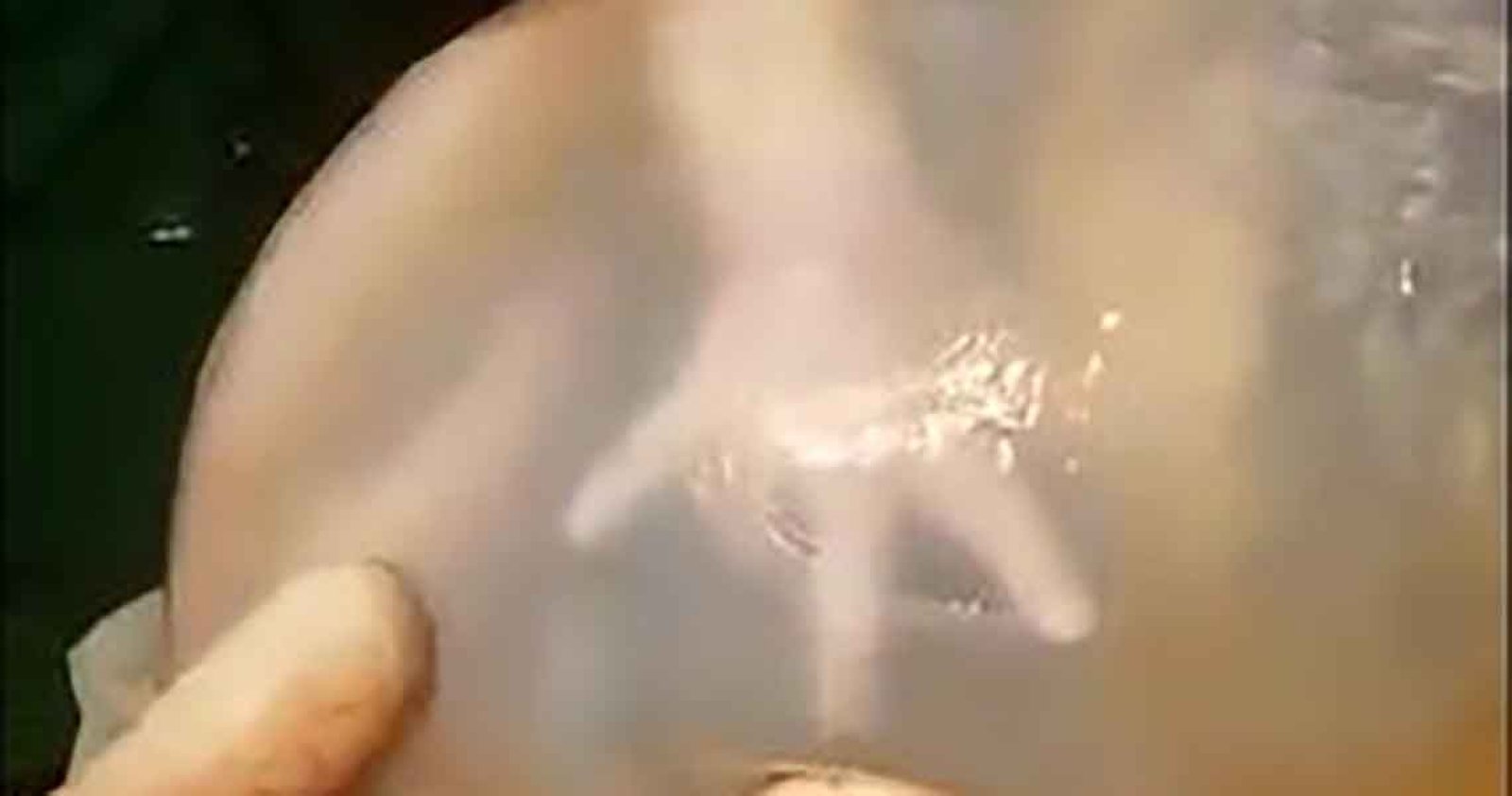 Imagem ilustrativa: Imagens mostram fato raro em nascimento de bebê em Santo Ângelo