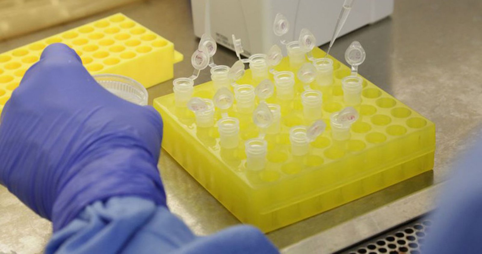 CD do HSA realiza teste molecular para diagnóstico do Covid-19